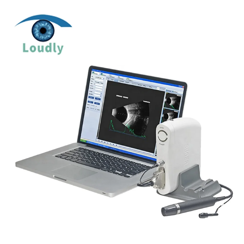High Quality Ophthalmic A/B Ultrasound Scanner Eye Ultrasound Scanner For Hospital