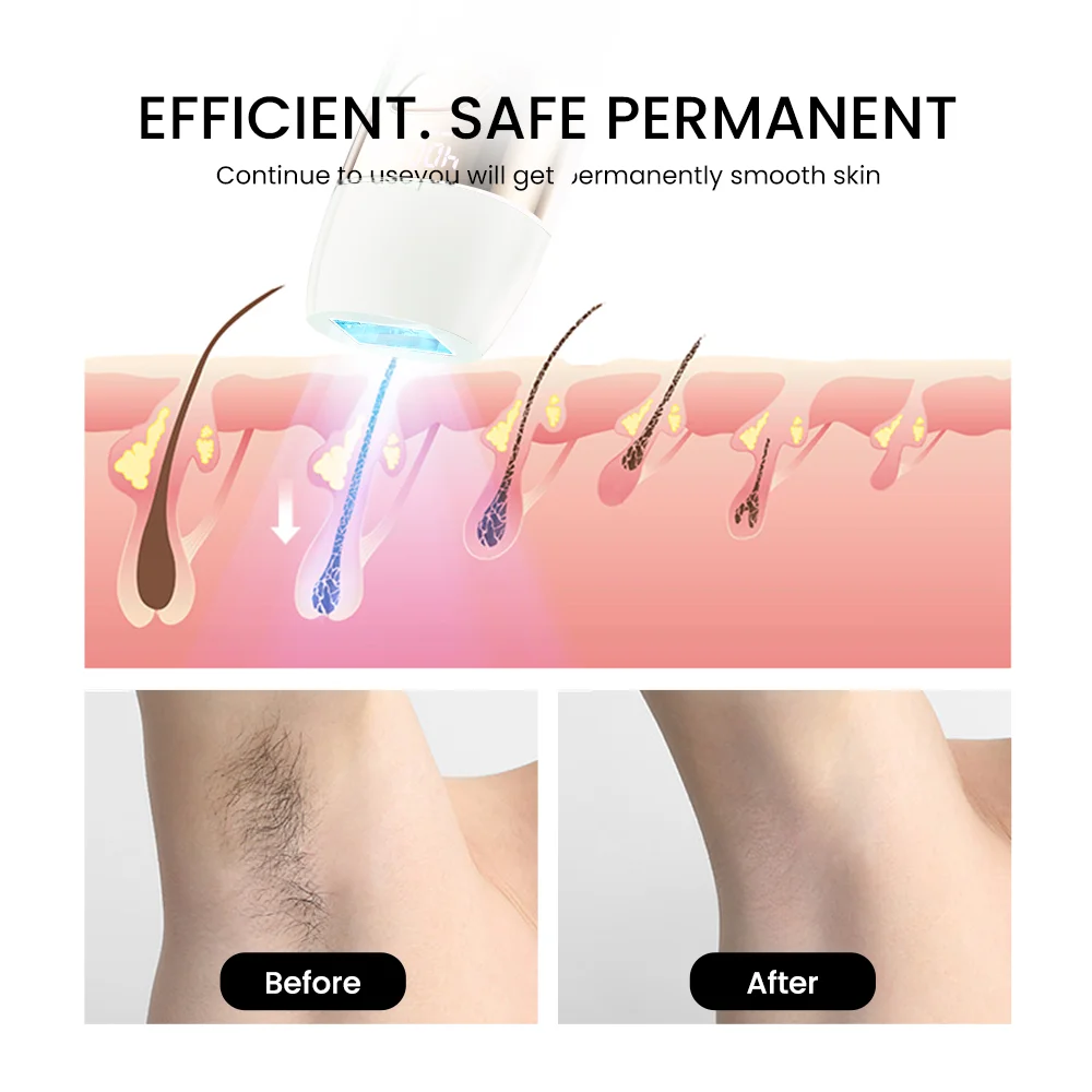 OEM/ODM Smooth Painless ipl hair removal Body Permanent Hair Removal Home Use ipl Hair Removing for Men and Women