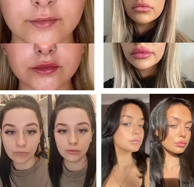 private label hyaluronic acid enhancer extreme filler lips plumping lipgloss volumizer plump it lip plumper gloss