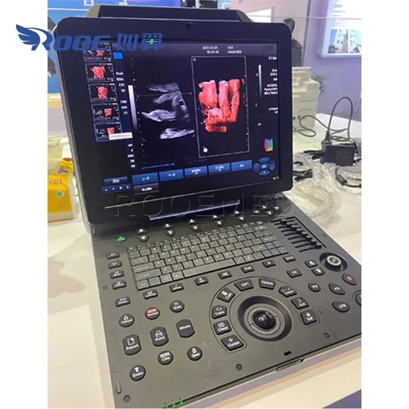 USC300PRO Medical Portable Scan Cardiac Color Doppler Ultrasound