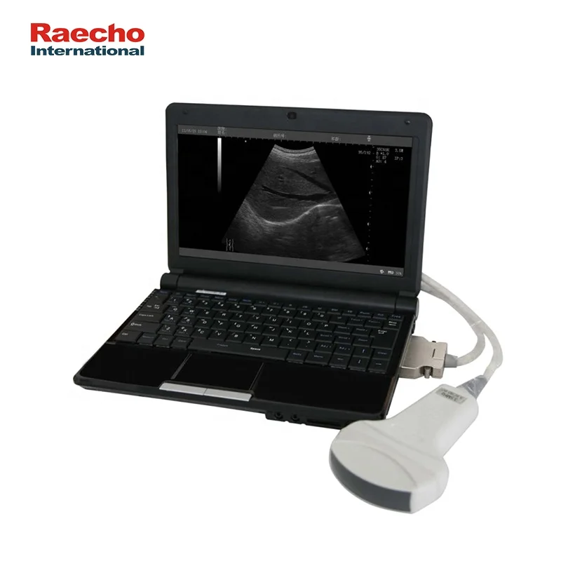 Portable Laptop Full Digital Ultrasound Black and White Ultrasound Machine for Clinic