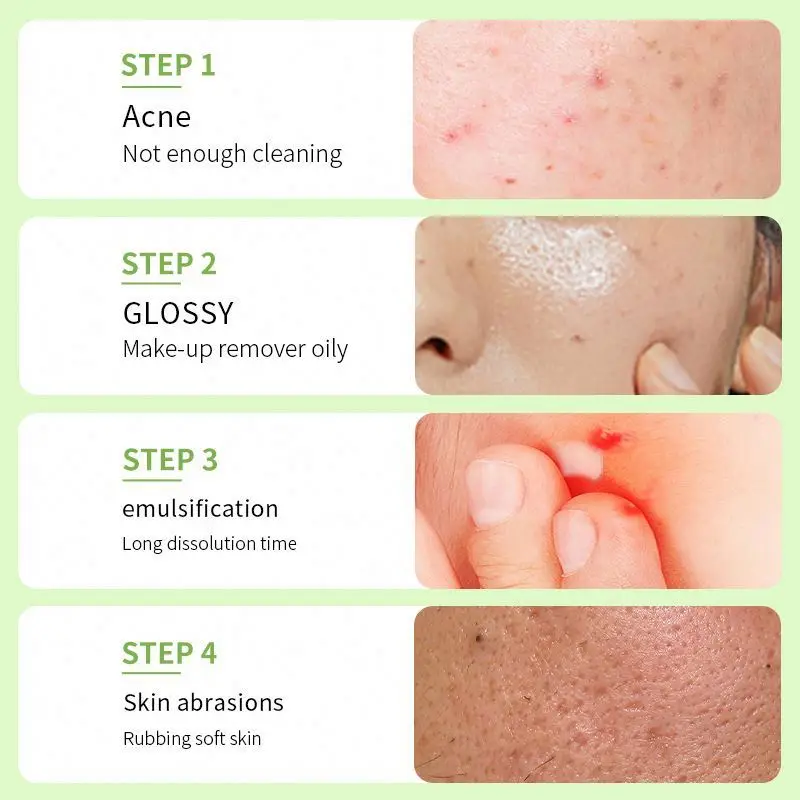 BIOAQUA Private Label Cruelty Free Avocado Face Eye Organic Facial Cleansing Oil Cocamide MEA Makeup Remover Cleanser Balm