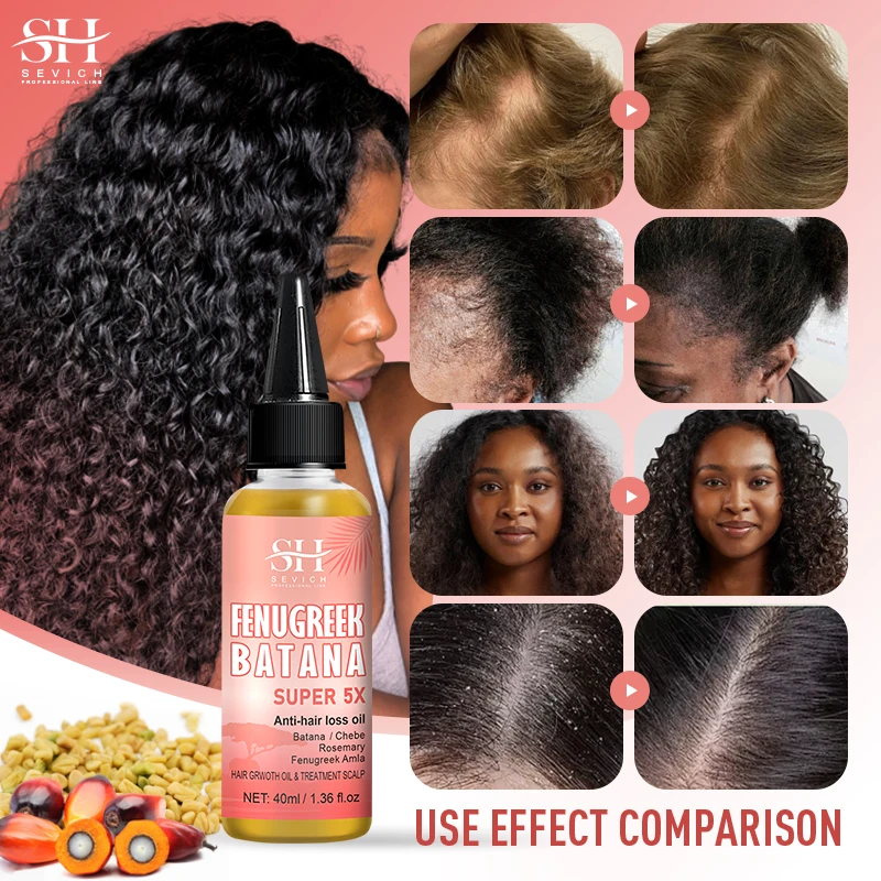 Private Label Natural Honduras Batana Alma Hair Oil Anti Loss Regrowth Treatment Scalp Fenugreek Super 5X Batana Hair Growth Oil