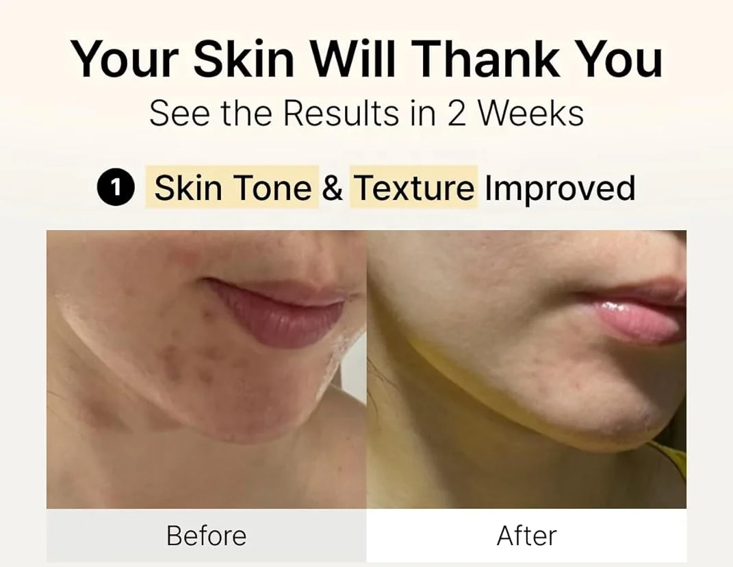 Rice Hydrating Milky Toner Glowing Non-Greasy Niacinamide Rice Milk Moisturizing Toner Instant Glow Facial Tonic
