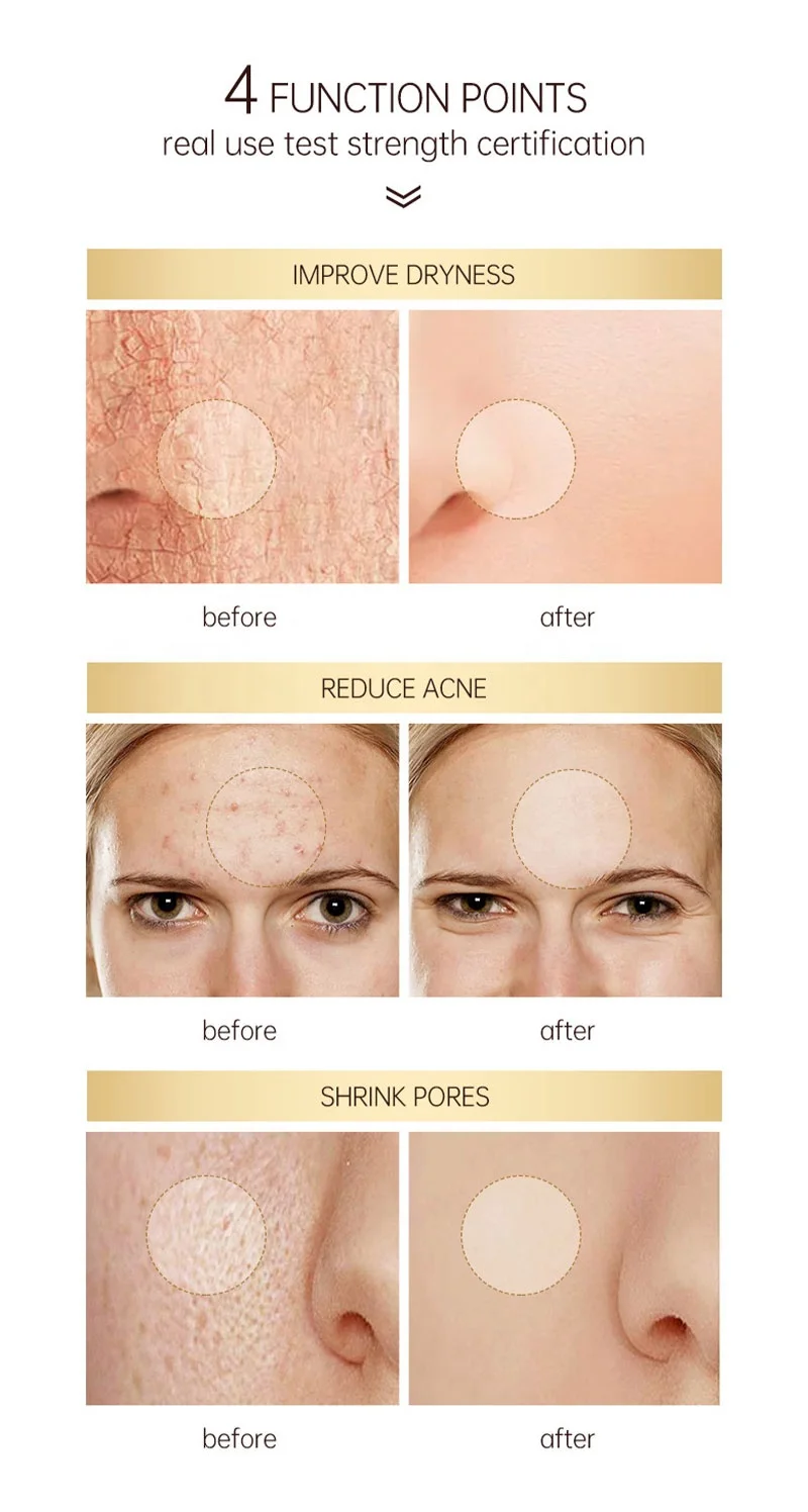 Hot Sales  Private Label Natural Organic Facial Skin Care Anti Aging Anti Wrinkle Retinol Face Serum