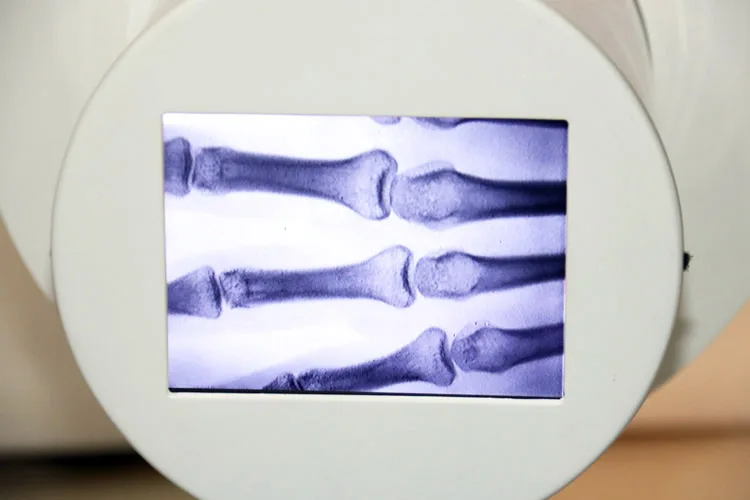 
Portable digital floroscope x ray machine, fluoroscopy connected with extra LCD screen 