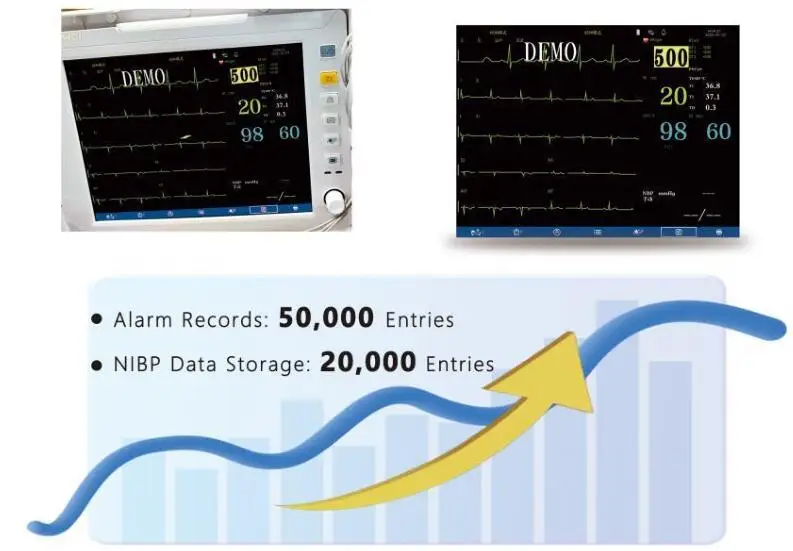 Professional  Factory Supplier 12.1 inch color LCD screen Multiparameter Patient Monitor Animal EKG Machine for Animal Use