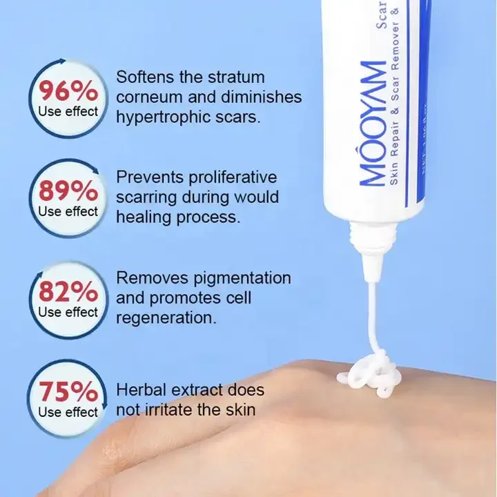 Fastest Acne Scar Removal Cream Face Care Scar Gel Bruise Repair Cream Tummy Tuck Tightening 30g Stretch Mark Scar Removal Cream