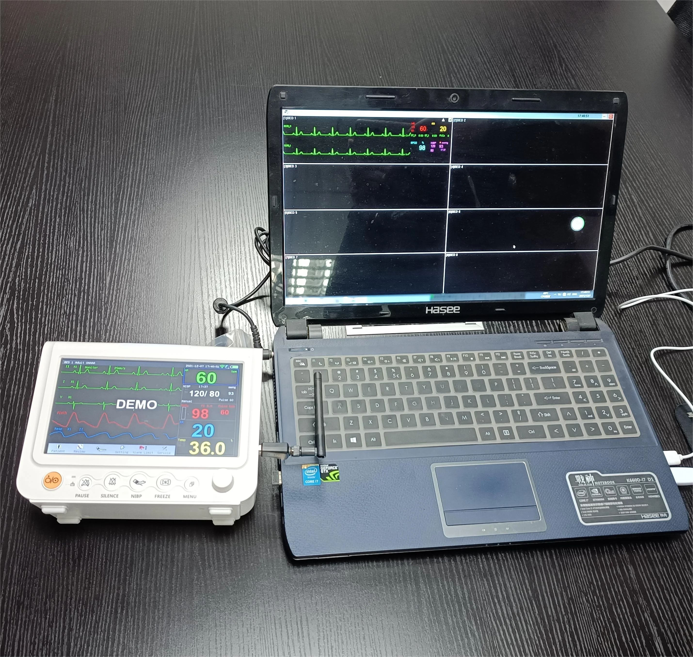 OEM SKD 7-Inch Veterinary Vital Signs Monitor for pets