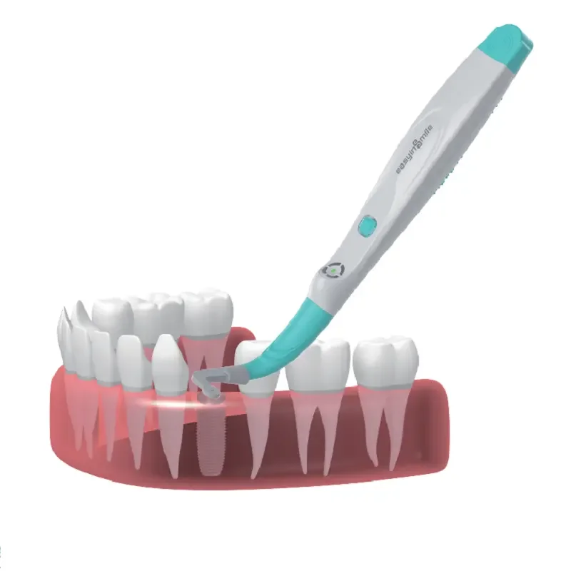 Новое поколение Easyinsmile вращающаяся головка датчика 270 градусов устройство для поиска зубных имплантатов 2-ступенчатой Имплантологии легко обнаруживаемый винт