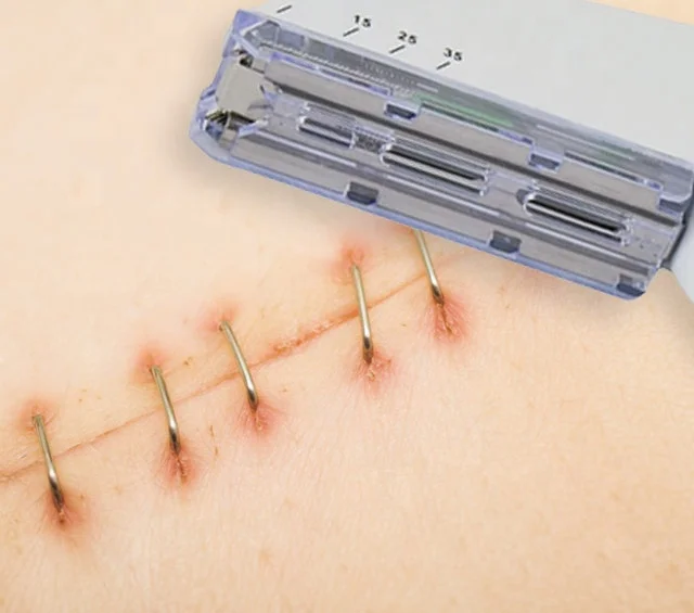 Cheap China Manufacturer  55w Disposable Vet Skin Stapler And Remover Price For Surgical Room