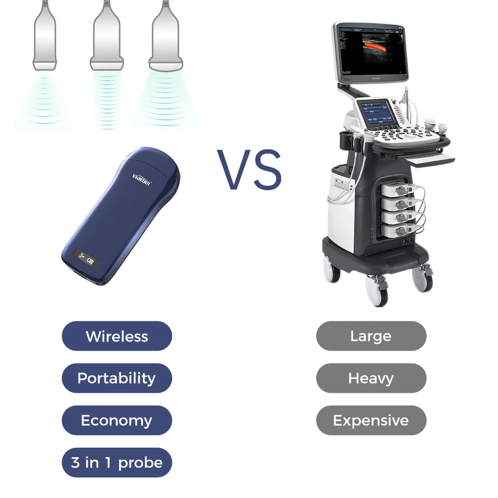 Viatom Handheld Ultrasound Probe 5 Display Mode One-Probe Multipurpose Wireless Portable Ultrasound Scanner