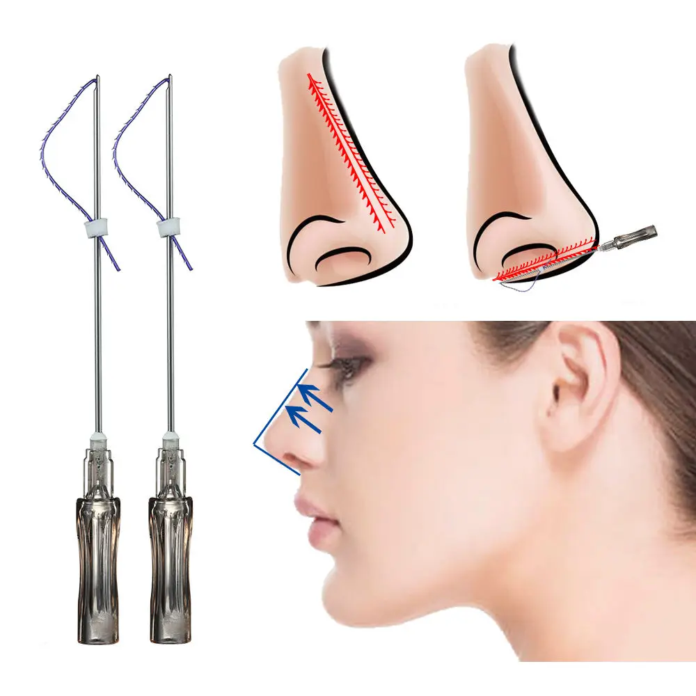 21G*38/50/60mm Pdo Thread Fishbone Molding Cog Pdo Barb Nose Threads Lift