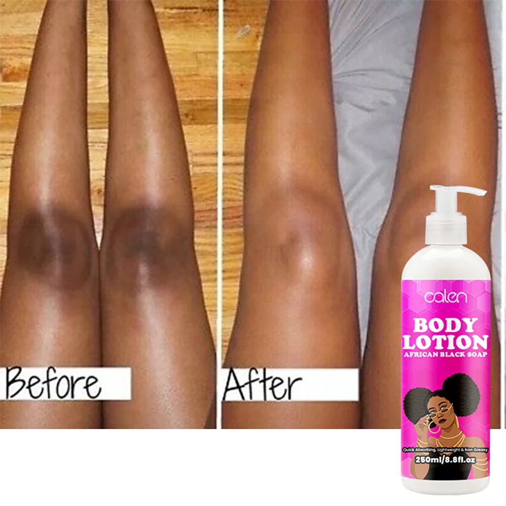 Oalen OEM ODM 250ml Brightening and Fading Dark Spots African Black Soap Hydrating Body Lotion