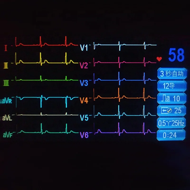 Good Price Medical Portable 3 Channel ECG Machine 12 Channel ECG Machine