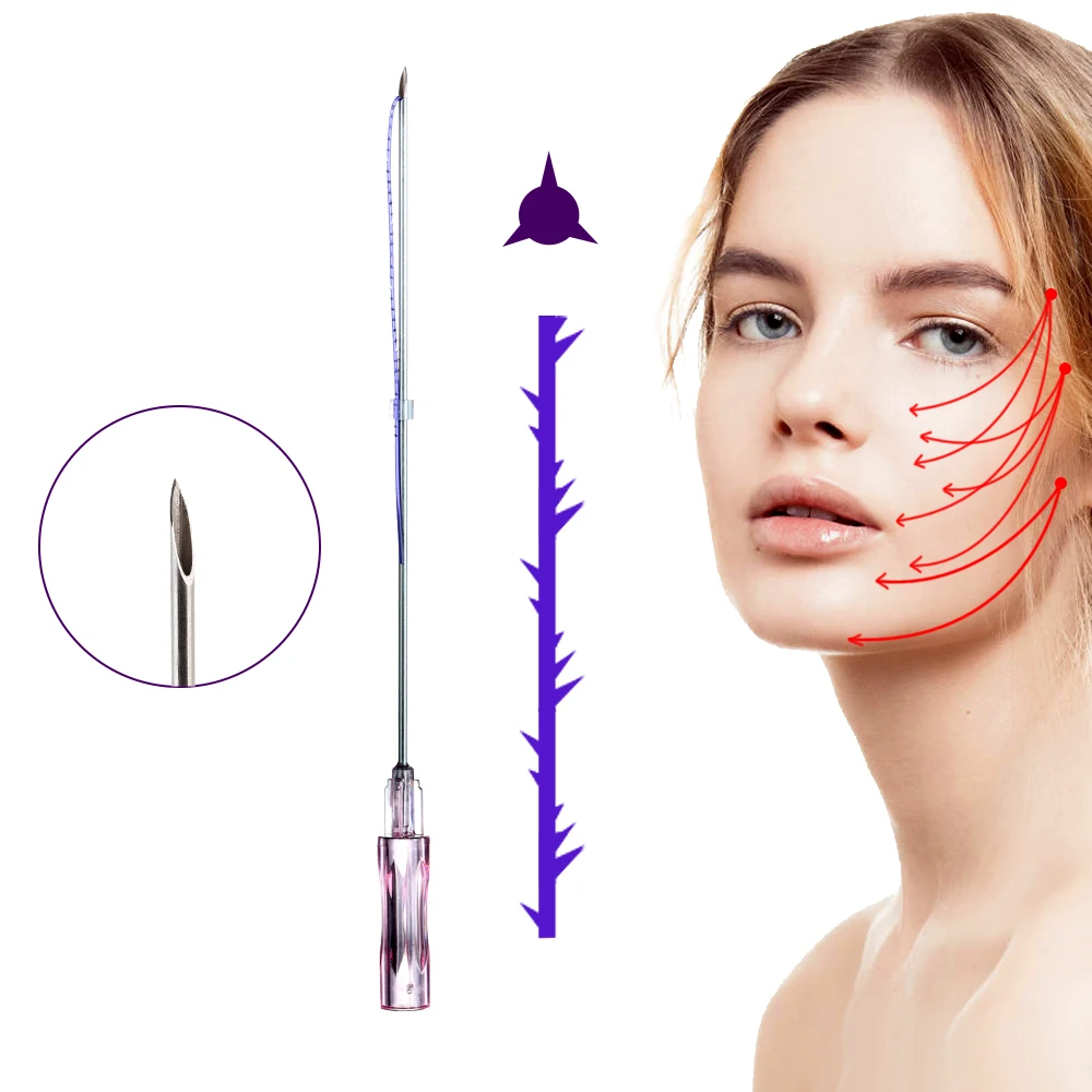 Non-Surgical Absorbable Face Lift Thread 19G 100mm Cog 3D Pdo Thread Sharp Needle