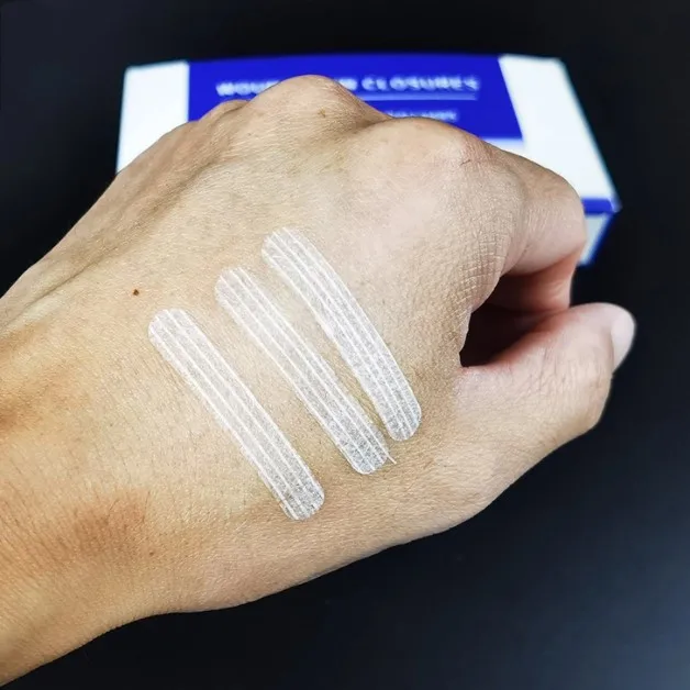 SJ Medical Disposable Factory Wholesale Customized Skin Closure Strip Surgical Adhesive Wound Dressing Closure Strips