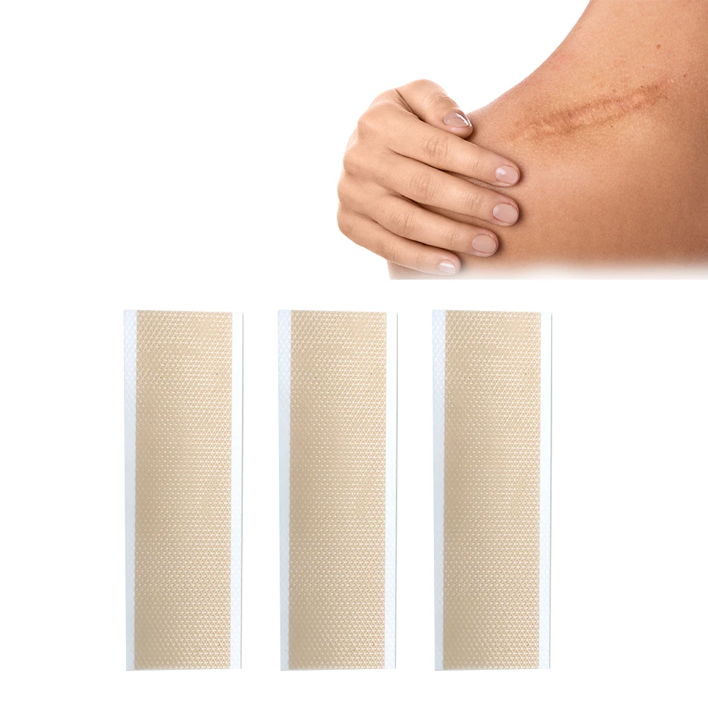 Hot Sale Adhesive Silicone Scar Gel Tape for Scars Tummy Tuck Burns Surgery Silicone Scar Gel Sheet