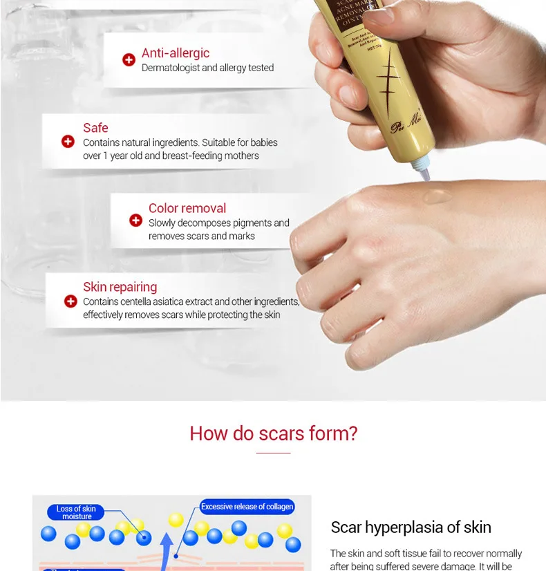 Light Print Scars Removal Face Cream Beauty Pure Skin Care Whitening Facial Moisturizing Acne Treatment Face Burn Scar Removal C