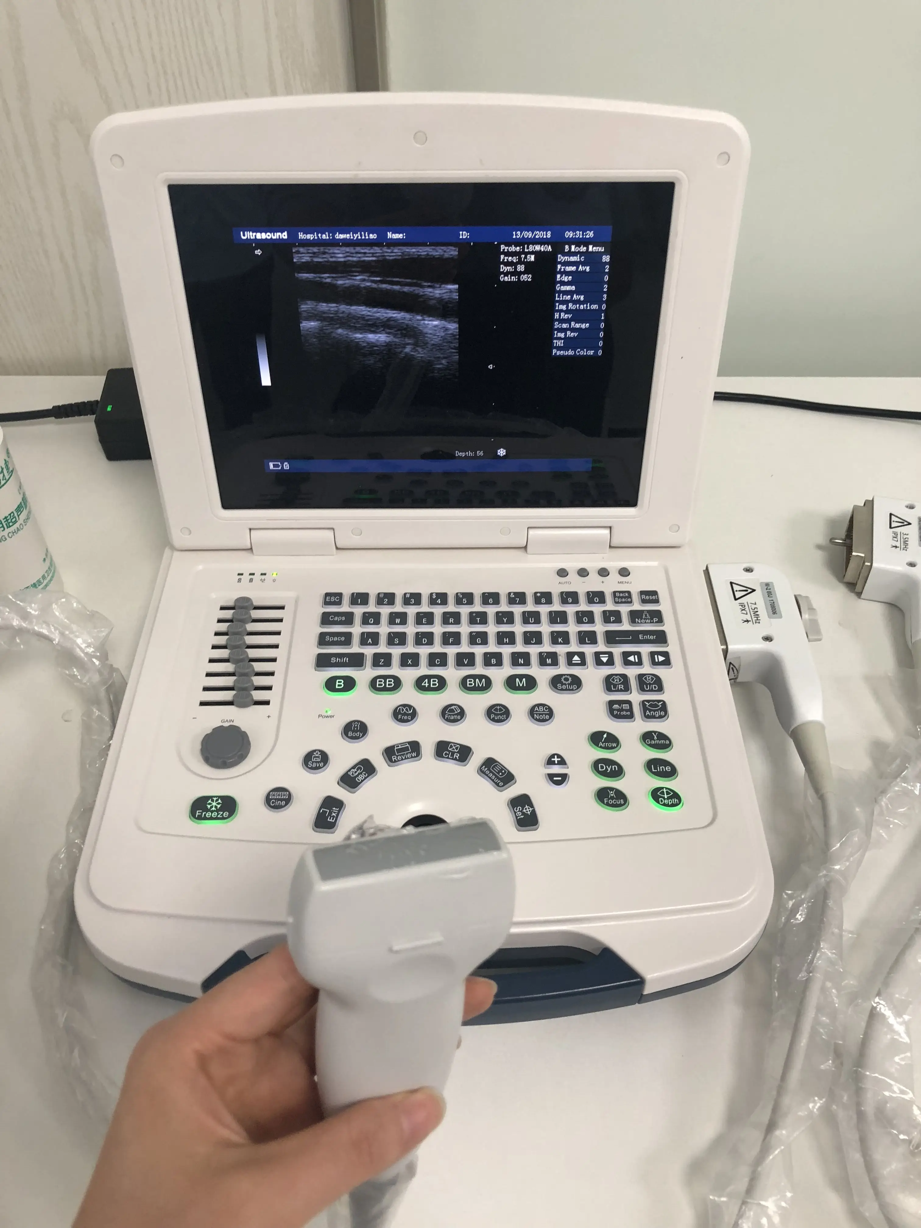 DW-580 low price portable ultrasound scanner & medical equipment