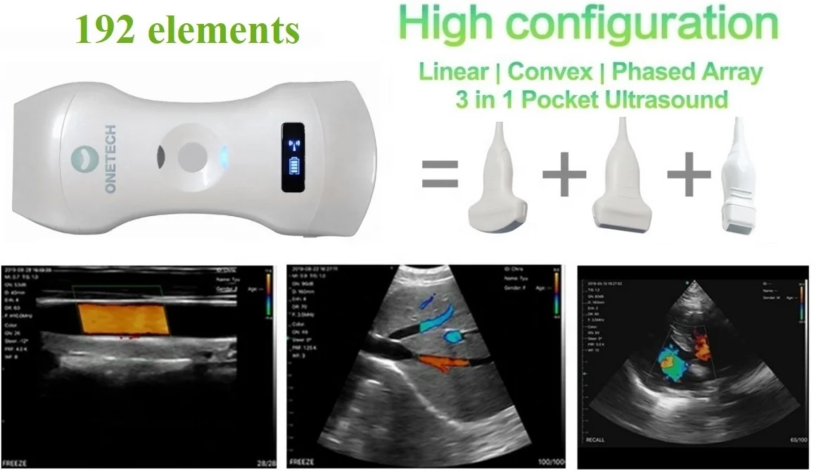 B26G Double Head Wireless Ultrasound Probe Portable Doppler Ultrasound Phased and Linear Wireless Ultrasound Scanner CE