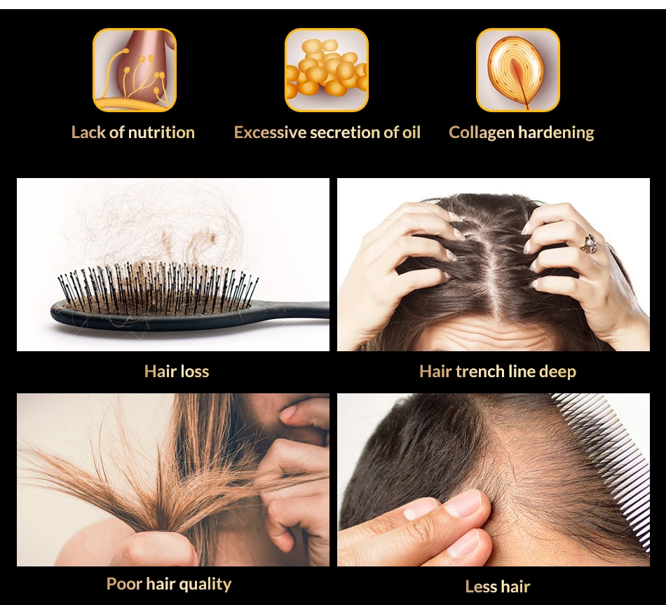 Быстрая эффективная Сыворотка для роста волос 7 дней лечение кератина для остановки падения волос