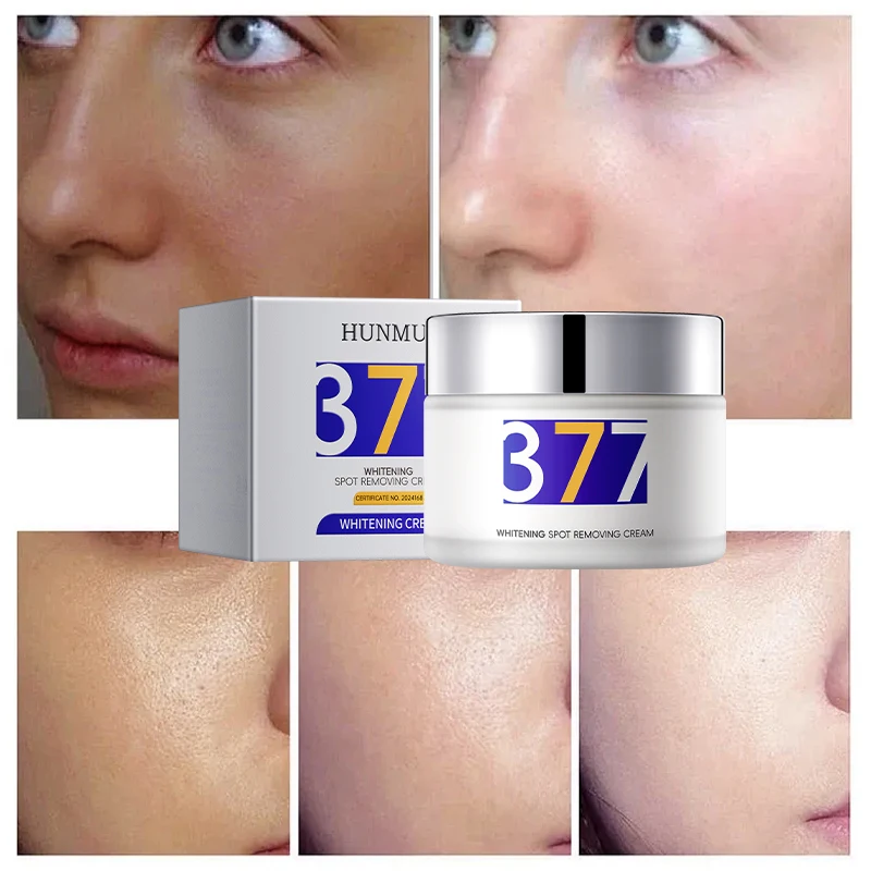 customized morning and evening cream whitening, fading, spot protection, color control, spot removal cream