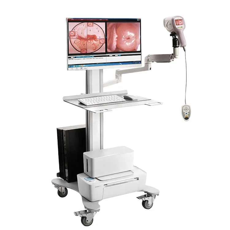 Trolley Type Colposcop with HD Camera Video Colposcope Digital Electronic Colposcopy Colposcope for Gynecology