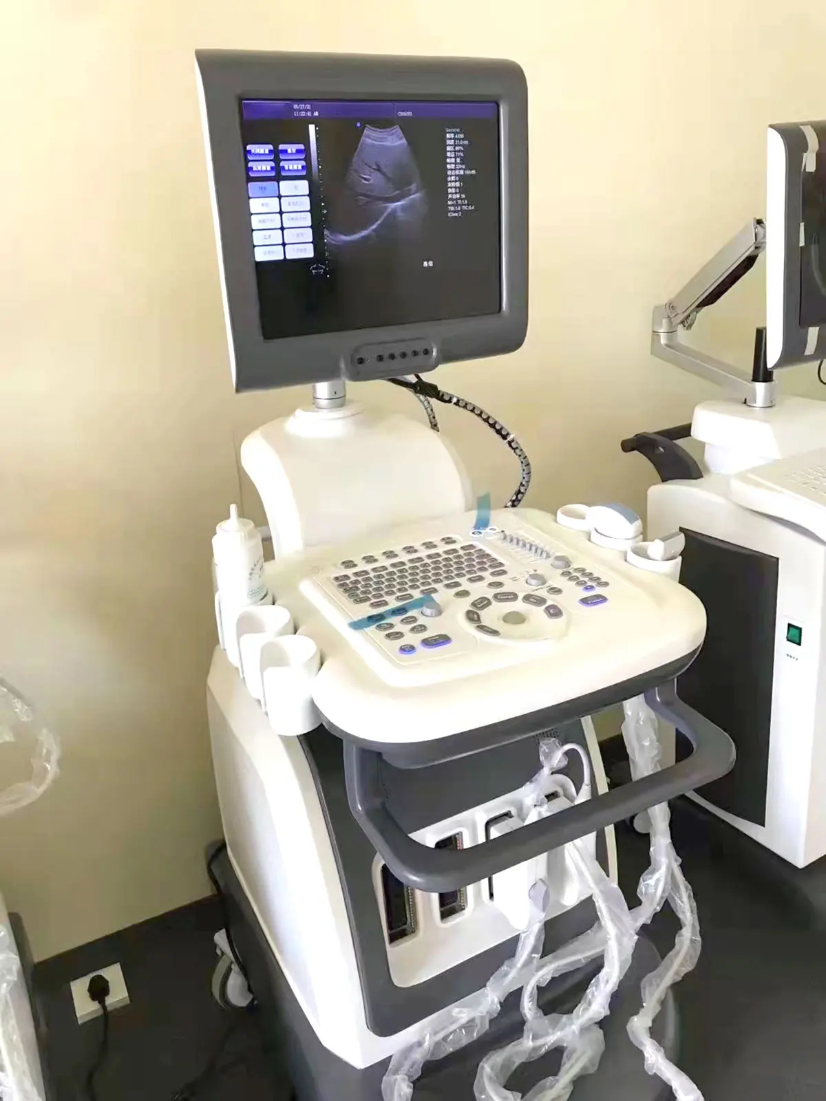 Full Digital Mobile Echocardiography Cardiac Echo Ultrasound Scan Color Doppler Ultrasound Machine for Pregnancy