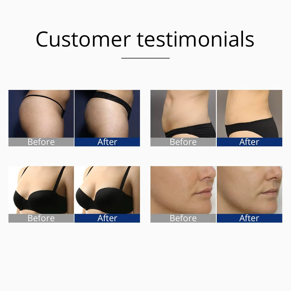 Новый стимулятор мышц EMS вакуумный аппарат для подтяжки ягодиц и уменьшения жира кожи лица оборудование салонов красоты