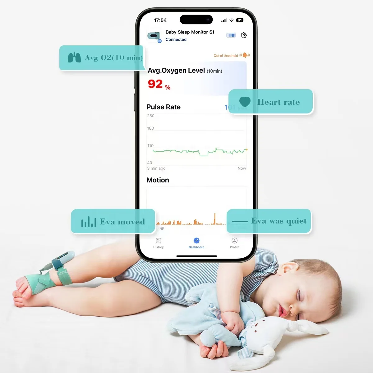 Viatom BabyO2 Wearable Foot Monitor with Bluetooth Baby Sleep Monitor Pulse Oximeters Pediatric