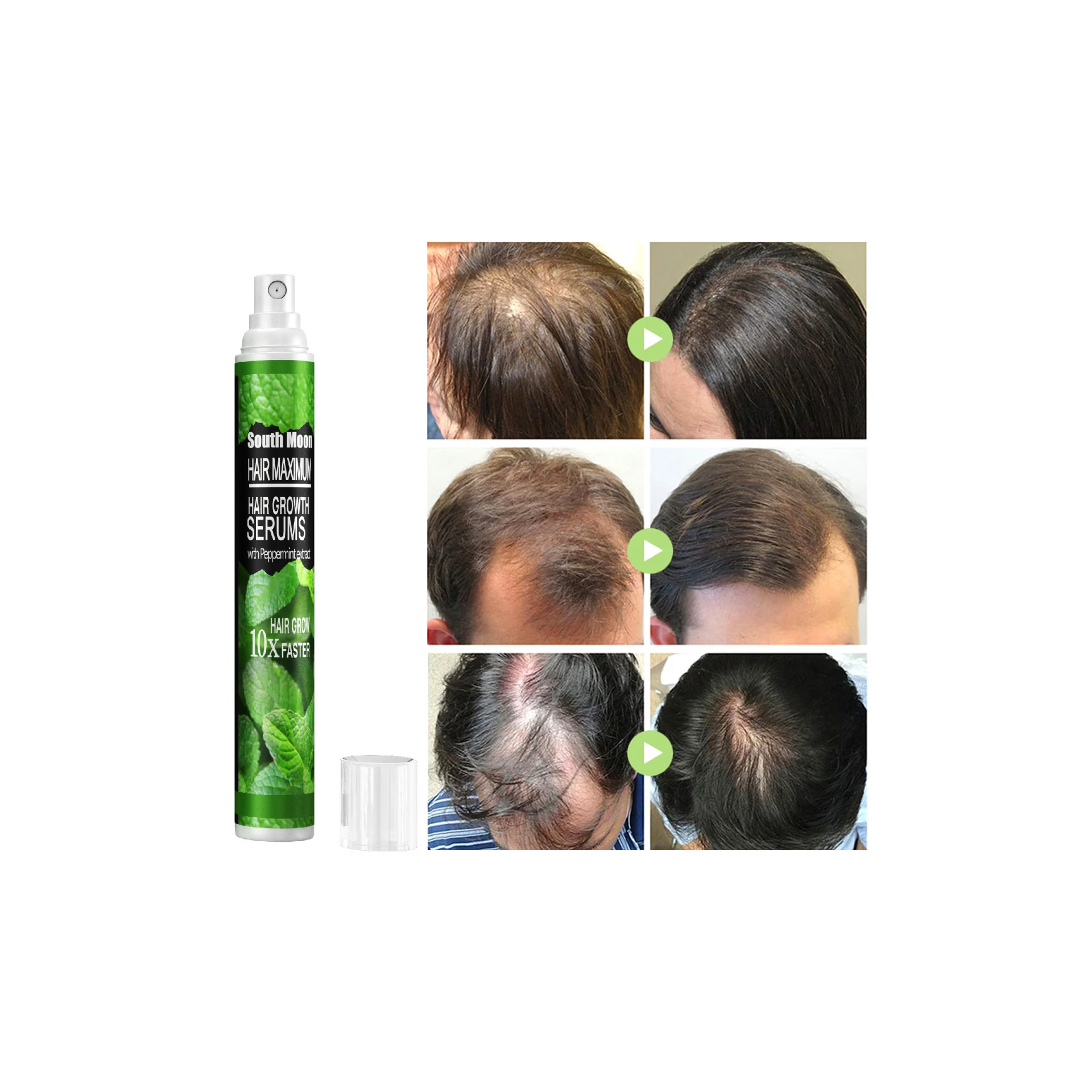 100% Herb Wholesale Mint Hair Growth Serum Spray Instant Hair Regrowth Anti Loss Care Hair Treatment Germinal Oil Spray