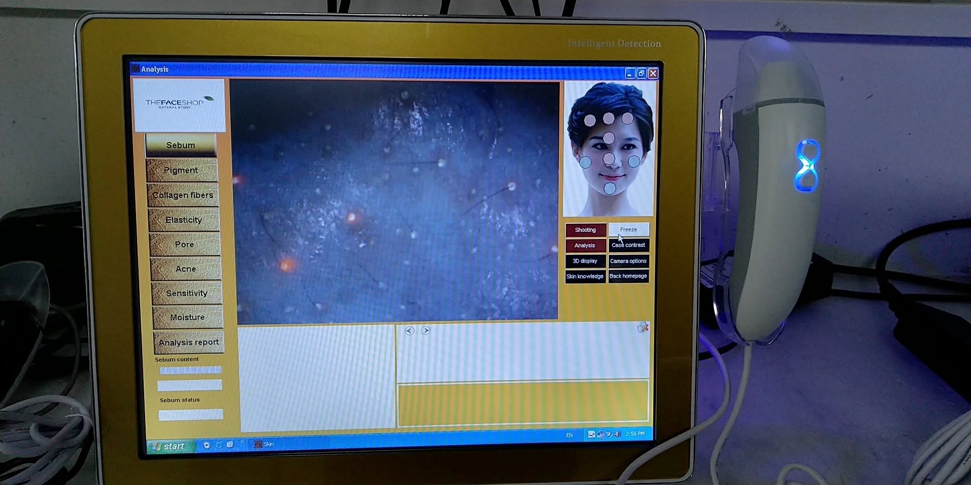 3D Skin Analysis Software Skin Analyzer Machine skin analyser