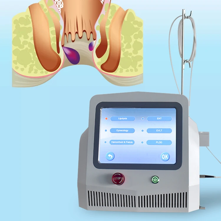 New 1470nm diode laser equipment for Hemorrhoids Fistula surgery treatment