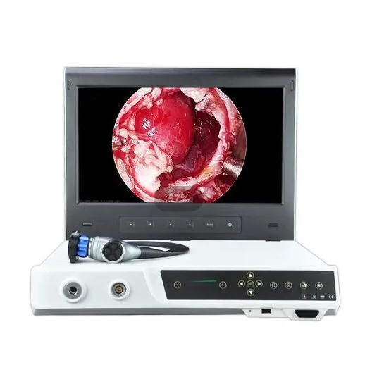 AKX Hot Selling Full HD All-in-one Video Endoscope Camera Endoscope Portable Design