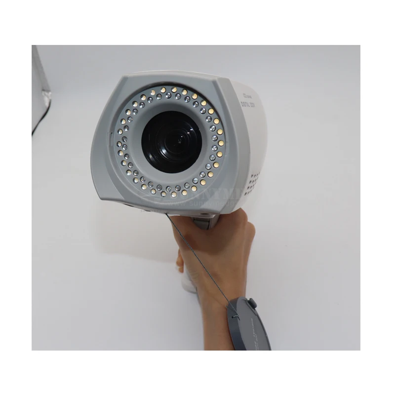 SY-F005 Gynecology examination digital video colposcope portable vaginal endoscope