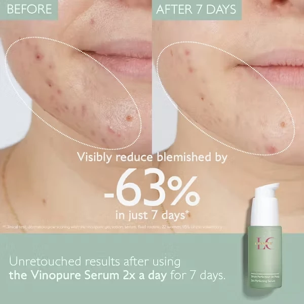 Private Label Natural Salicylic Acid Acne Skin Care Set Pores Minimizing Blemishes Acne Prone Skincare Essentials Set Kits