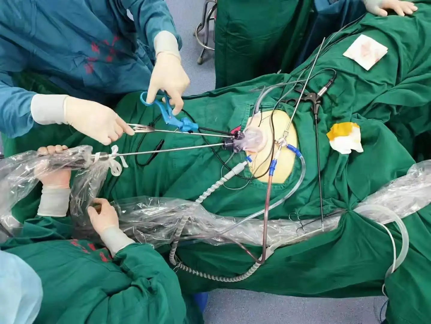Cystoscope NP-3X (Child type), Urological surgical instruments