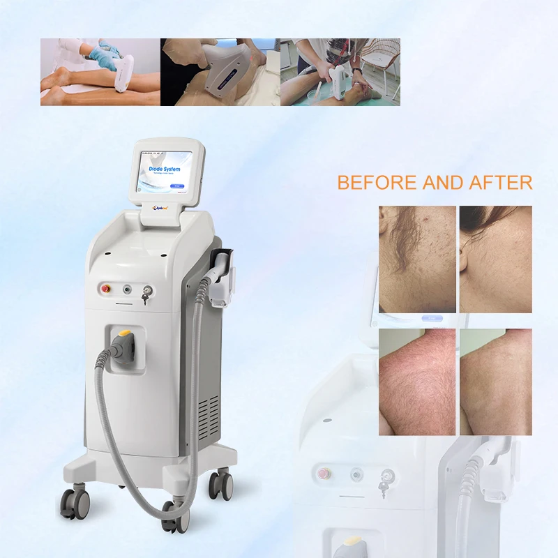 New Beauty Equipment 808nm Diode Laser Device Pain Free Permanent Hair Removal Skin Rejuvenation Whitening Machine