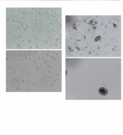 Dual Channel Automated Feces Analyzer/Analyzes of A Jar of Feces