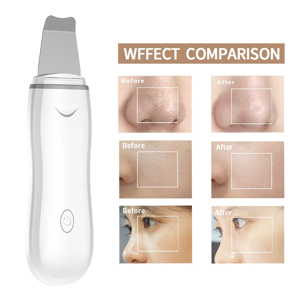 Wholesale Professional Skin Care Facial Exfoliating Device Ultrasonic Skin Scrubber Deep Face Cleaning Face Skin Scrubber