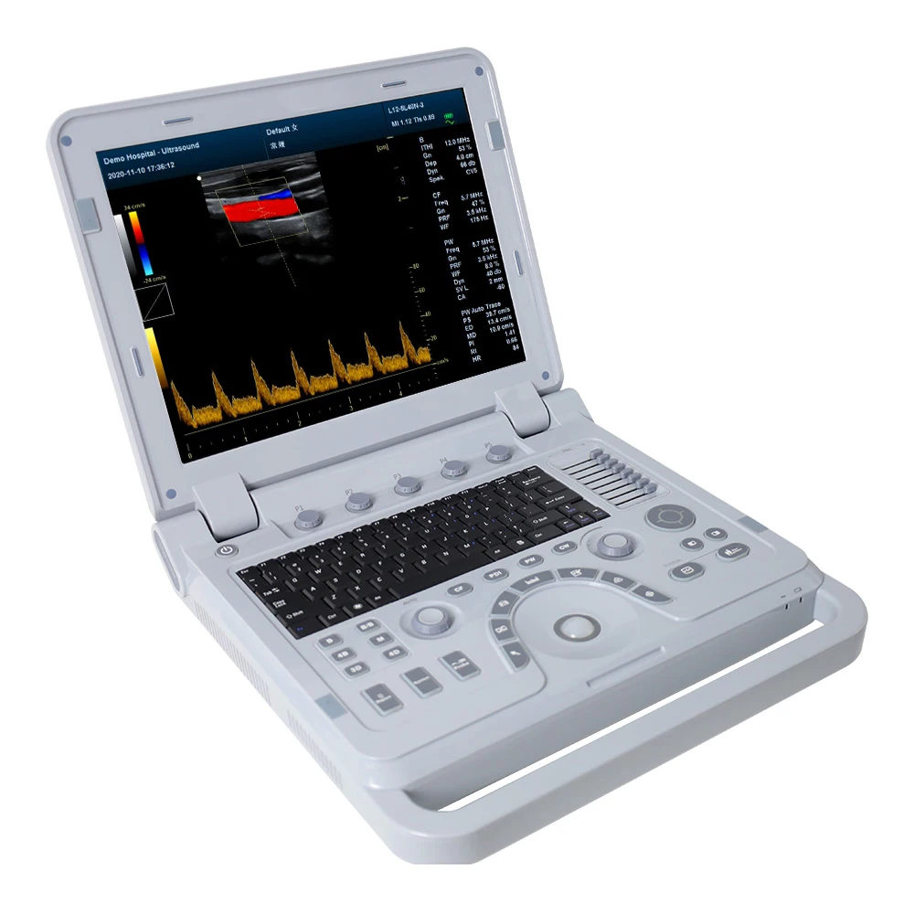 CONTEC CMS1700B, Акушерская Урология живота, кардиопедическая гинекология, периферическая сосудистая диагностика, Цветной Допплер
