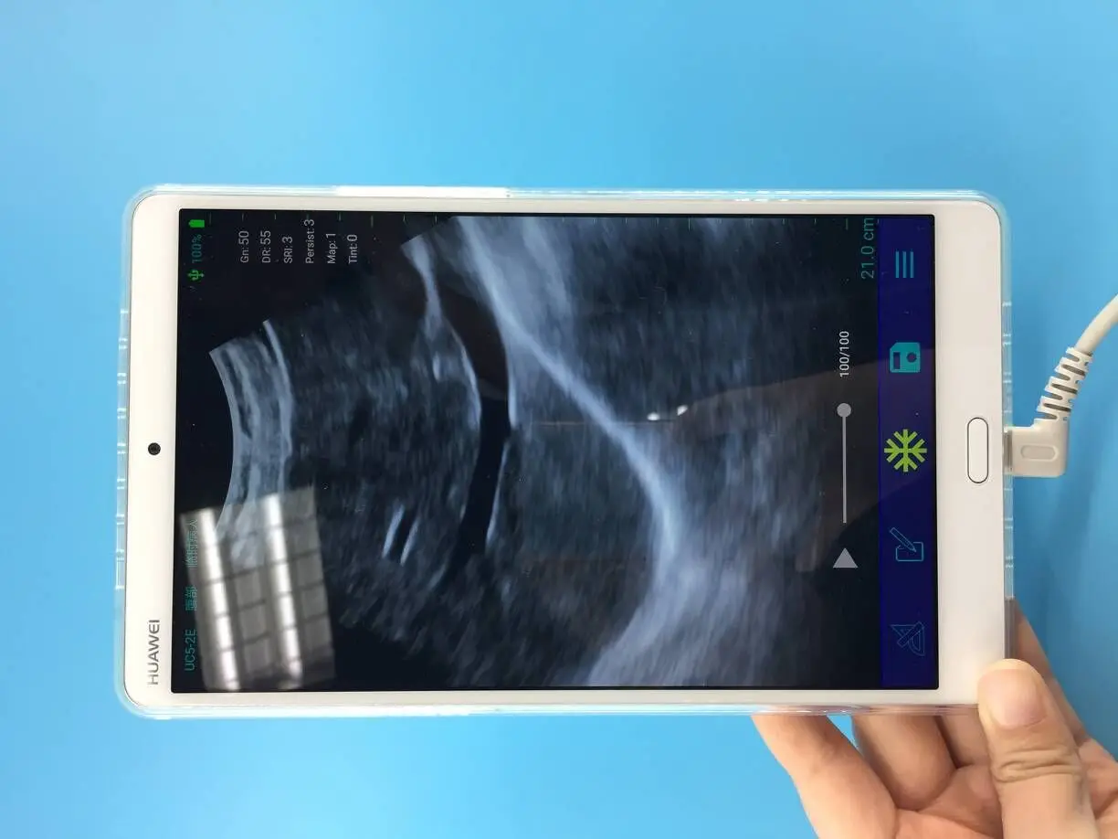 Digital ultrasound probe pocket machine ultrasound system