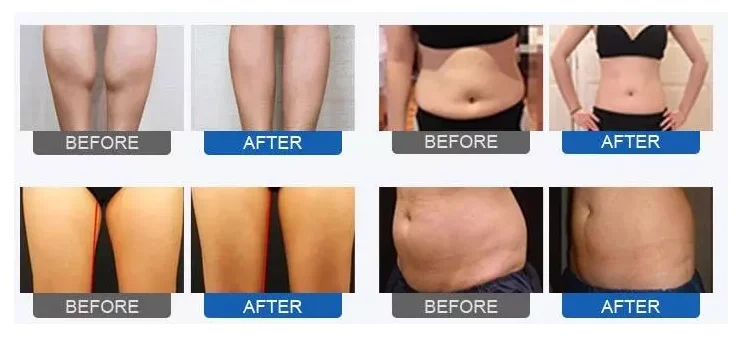 Technical vibration massage air pressure pressotherapy machine