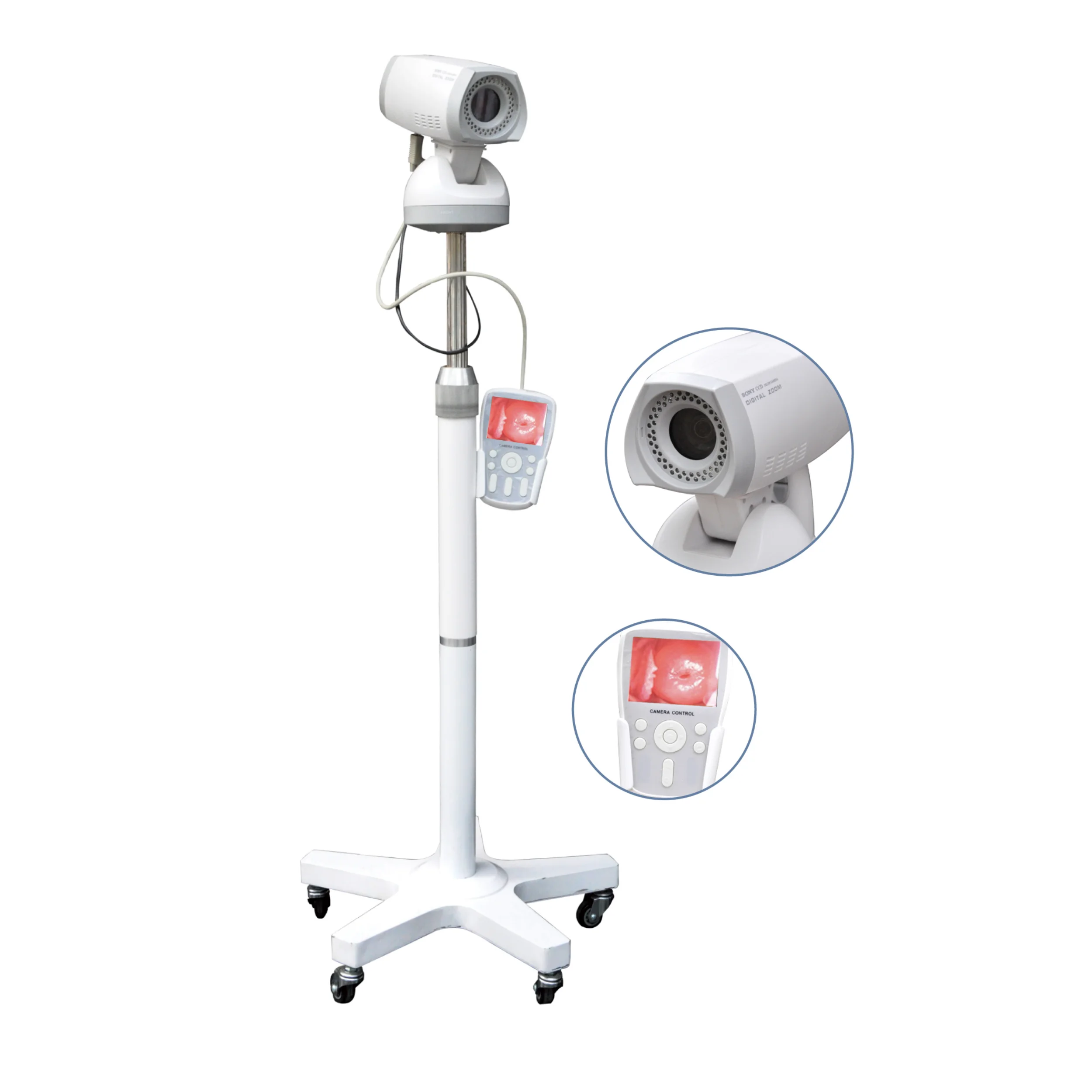 DMCC02 Hospital Portable Digital Video Colposcope For Gynecology  Machine With Sony Lens Diagnostic Equipment