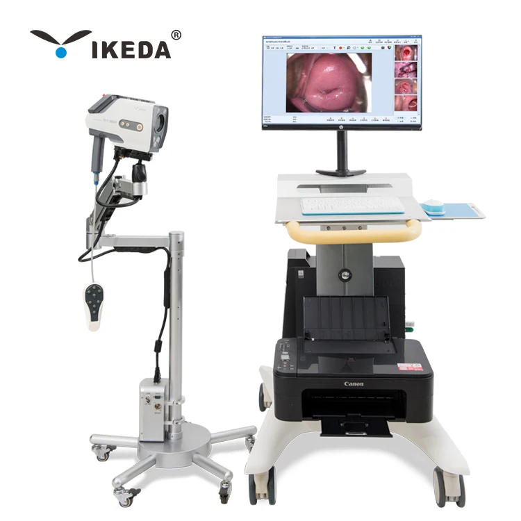 ikeda 1080p hd vagina pictures colposcope cheap price