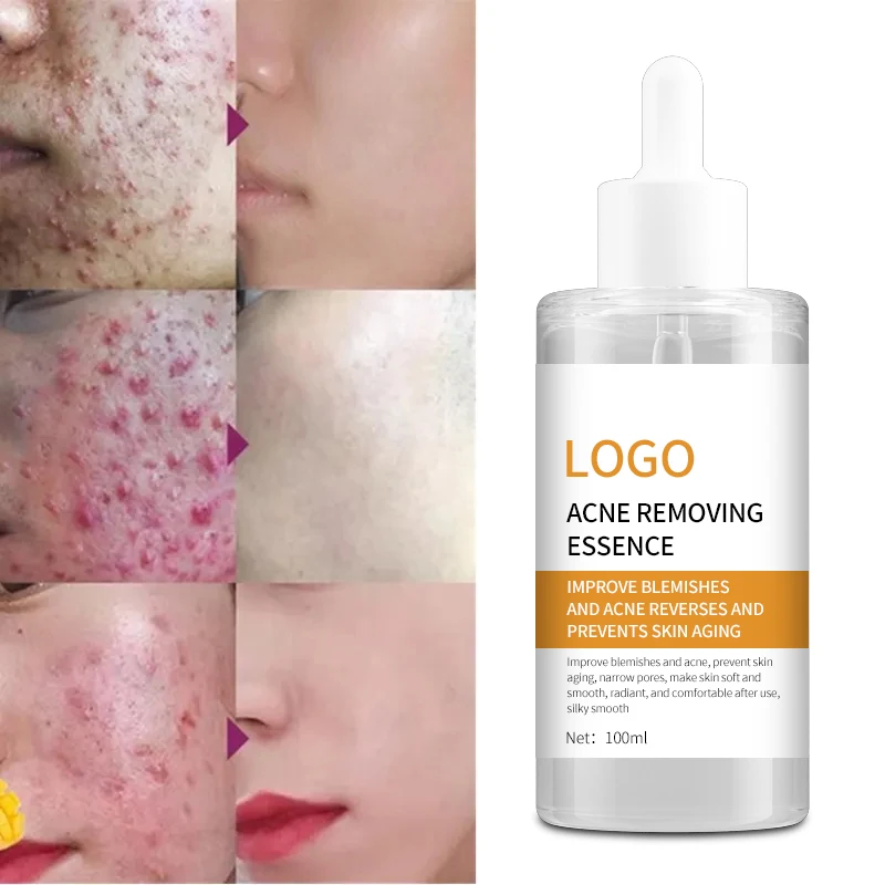 Private Label OEM  moisturizing Dark Spot Remover whitening anti aging removal salicylic acid Acne  turmeric face serum
