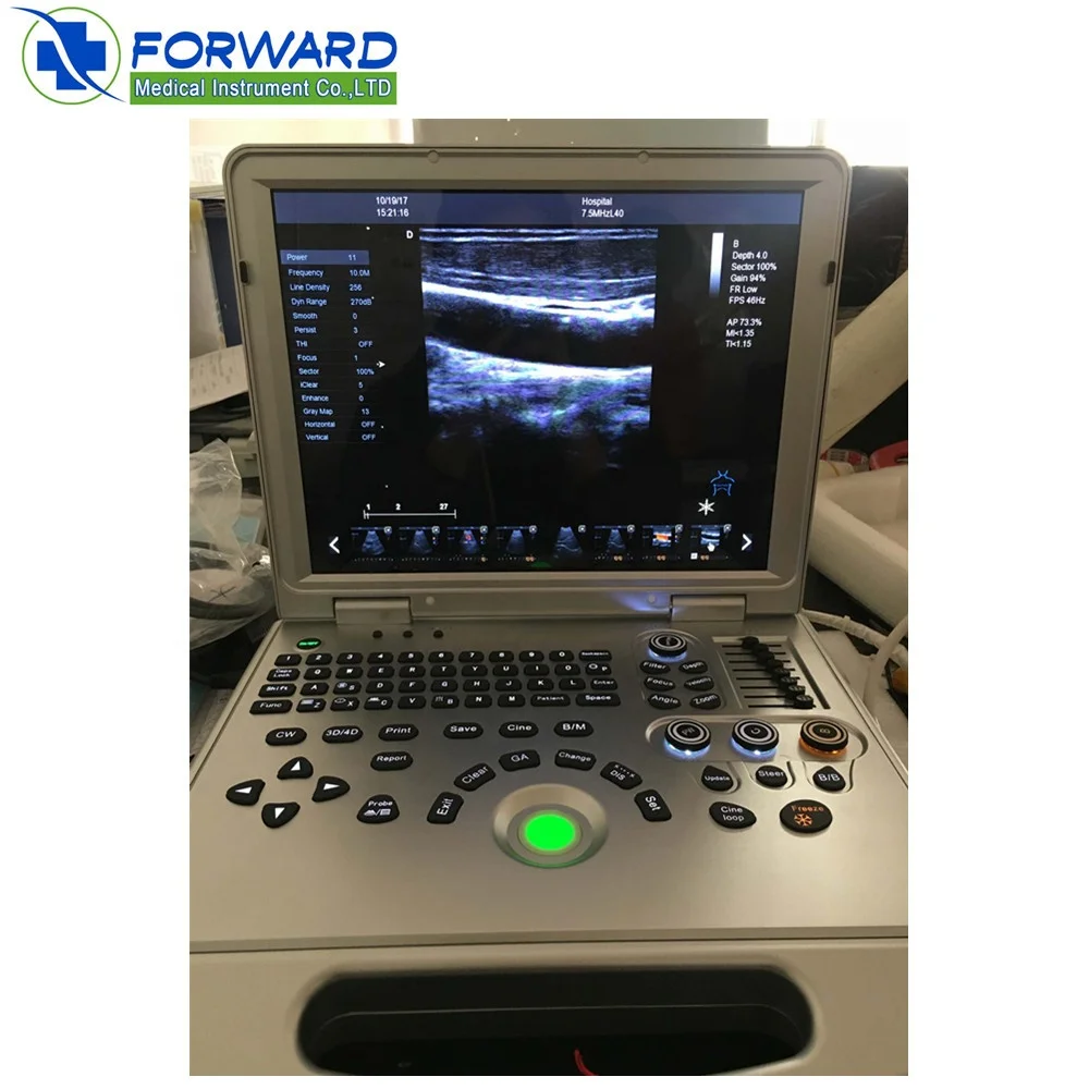 4D laptop portable color doppler ultrasound machine for human