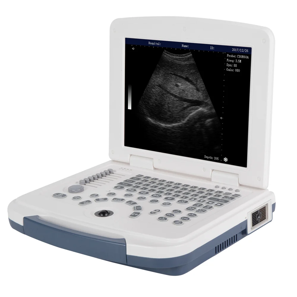 Best Price Medical Diagnostic Equipment 12.1 Inch LCD Display Full Digital B/W ultrasound Machine