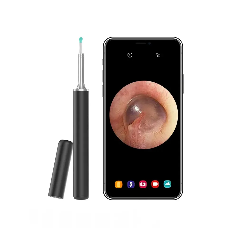 Multifunctional Mini Ear Camera Nose Throat Otoscope HD Visual Ear Cleaning Endoscope